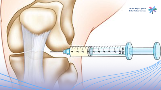 عروض-حقن-بلازما-للركبة
