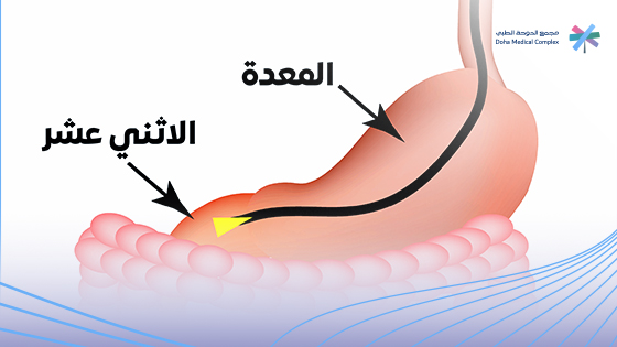 أنواع-مناظير-الجهاز-الهضمي