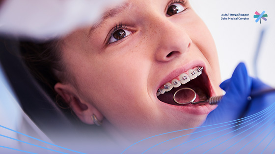 أنواع-تقويم-الأسنان-بالصور-واسعارها 