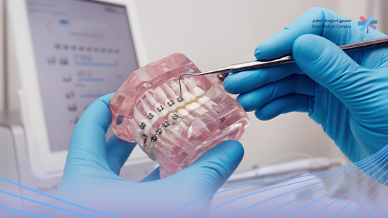 أنواع-تقويم-الأسنان-بالصور-واسعارها 