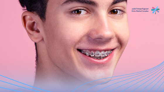 أنواع-تقويم-الأسنان-بالصور-واسعارها 