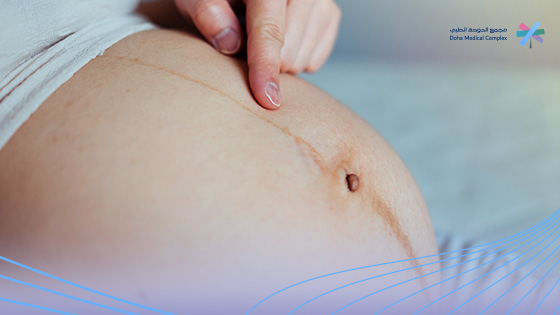 خط-البطن-للحامل 