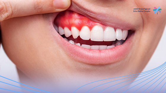 تعفن-مكان-خلع-الضرس