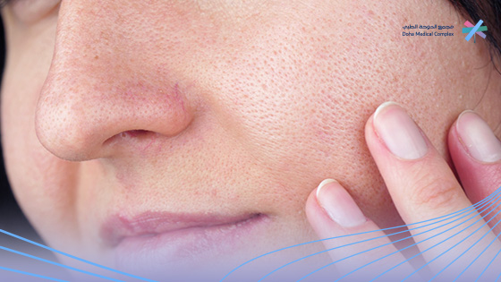 كيف-اعرف-نوع-بشرتي-بالصور