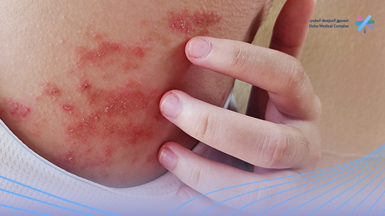 ظهور-حبوب-في-المهبل