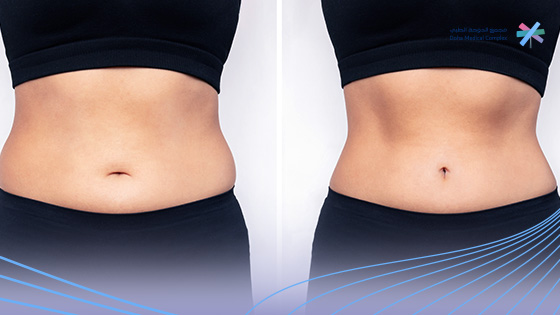 سعر-ابر-مونجارو-في-السعودية