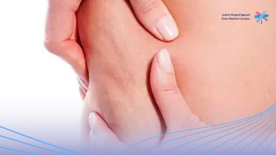 اسباب-ظهور-السيلوليت