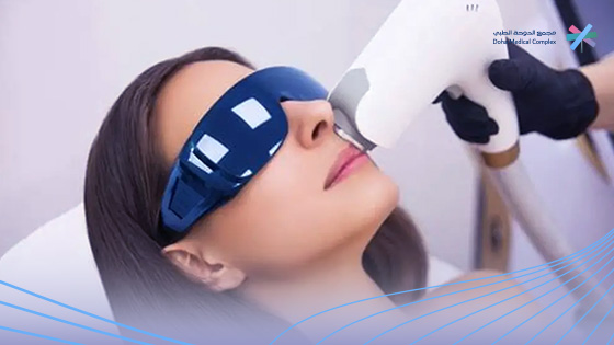 جلسة-الاكزيمر-ليزر