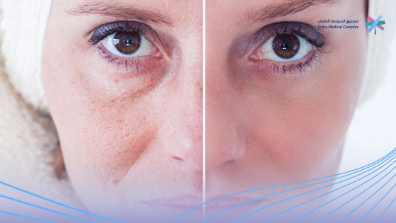 تعليمات-بعد-الشد-المائي