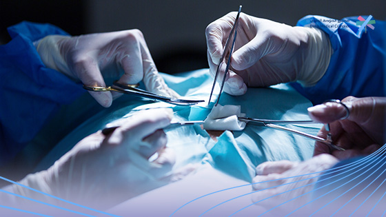 هل-عملية-استئصال-الطحال-خطيرة