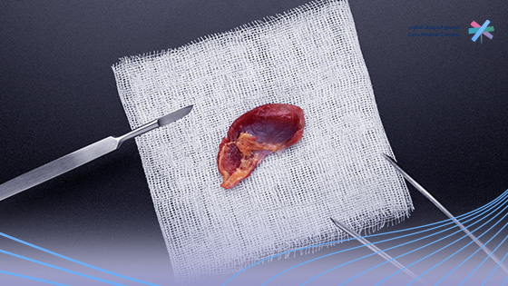 كم-يستغرق-وقت-عملية-استئصال-الطحال