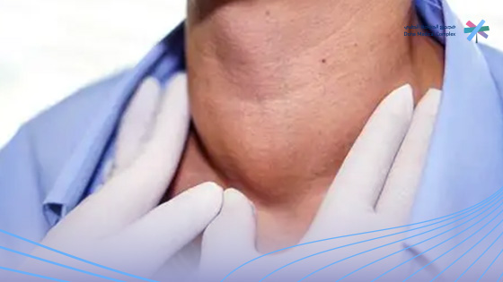 بعد-استئصال-الغدة-الدرقية