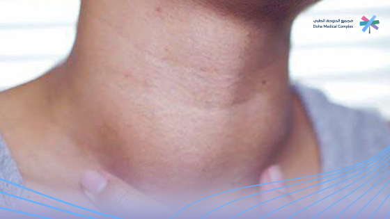 سعر-عملية-استئصال-الغدة-الدرقية-في-السعودية سعر-عملية-استئصال-الغدة-الدرقية-في-السعودية