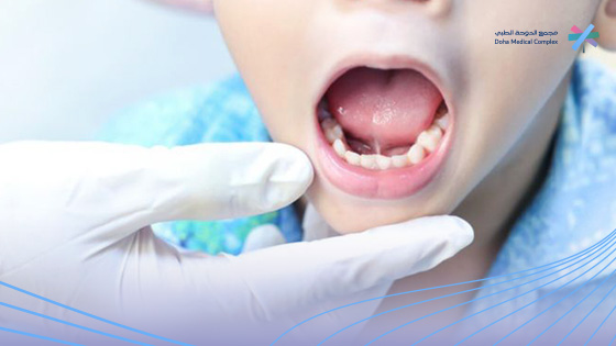 عملية-اللسان-المربوط-بالليزر