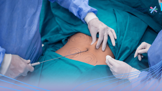 تكلفة-عملية-فتق-الحجاب-الحاجز-في-السعودية تكلفة-عملية-فتق-الحجاب-الحاجز-في-السعودية