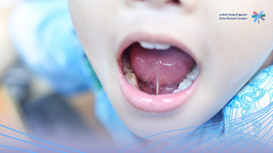 درجات-اللسان-المربوط درجات-اللسان-المربوط