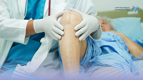 عملية-تغيير-مفصل-الركبة