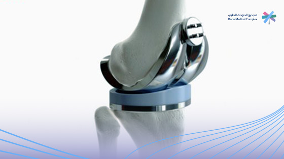 مدة-عملية-تغيير-مفصل-الركبة