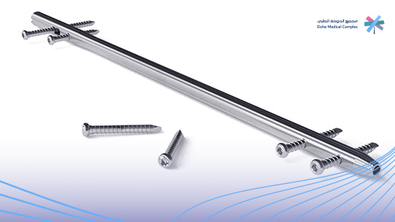  هل-عملية-إزالة-الشرائح-والمسامير-صعبة