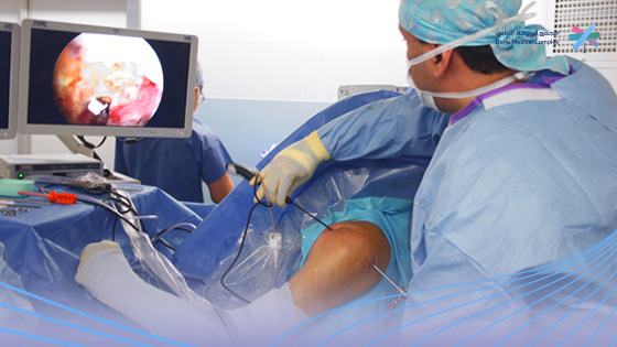 كم-تستغرق-عملية-قطع-وتر-الكتف