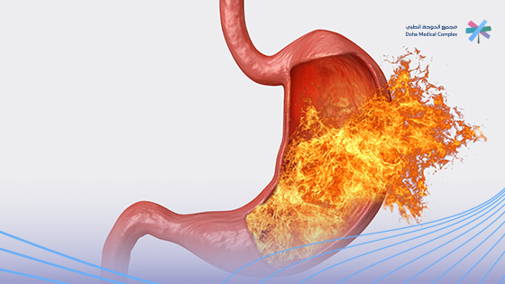 أعراض-قرحة-المعدة-العصبية