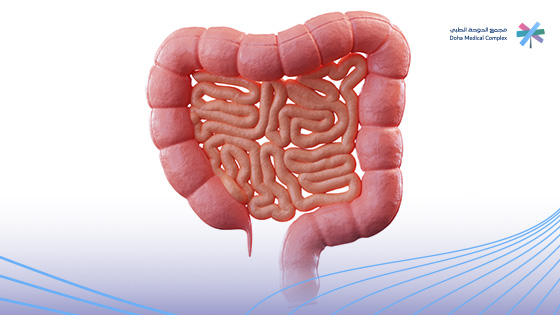 علاج-تقرحات-المعدة