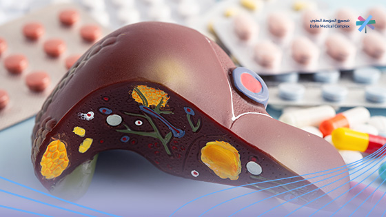 الأكل-الممنوع-لمرضى-الكبد-الدهني