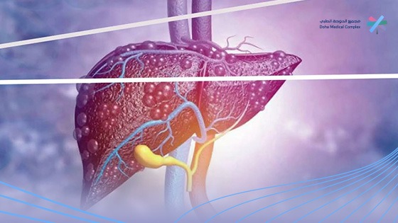 الأكل-الممنوع-لمرضى-الكبد-الدهني