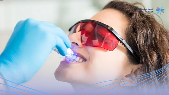  تقنية-تبييض-الاسنان-بالزوم