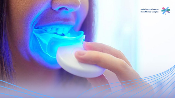 تبييض-الاسنان-بالزوم