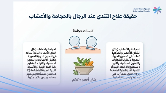 حقيقة-علاج-التثدي-عند-الرجال-بالحجامة