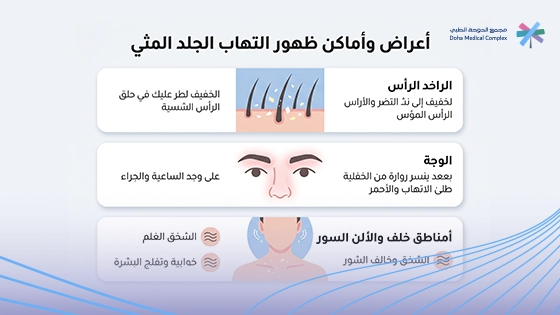 صورة-توضح-اعراض-التهاب-الجلد-المثي