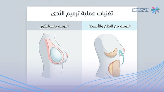 صورة-توضح-أنواع-ترميم-الثدي-بعد-الاستئصال صورة-توضح-أنواع-ترميم-الثدي-بعد-الاستئصال