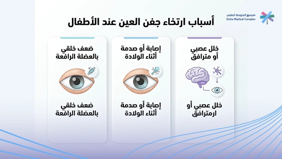 صورة-توضح-اسباب-ارتخاء-جفن-العين-عند-الاطفال