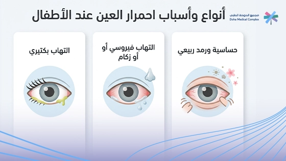 صورة-توضح-اسباب-احمرار-العين-عند-الاطفال