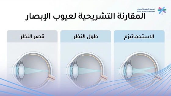 صورة-توضح-الفرق-بين-طول-النظر-وقصر-النظر-والاستجماتيزم