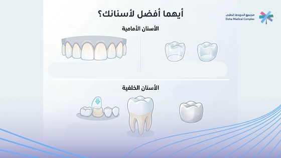 صورة-لتوضيح-ما-هي-افضل-اسنان-تركيب