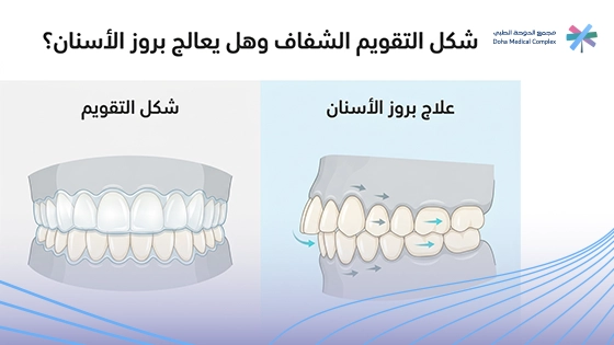 صورة-توضح-شكل-التقويم-الشفاف