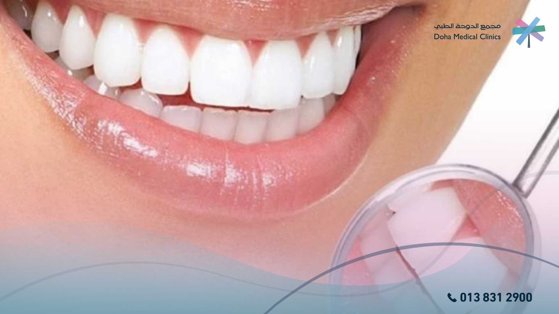 فوائد جسر الاسنان