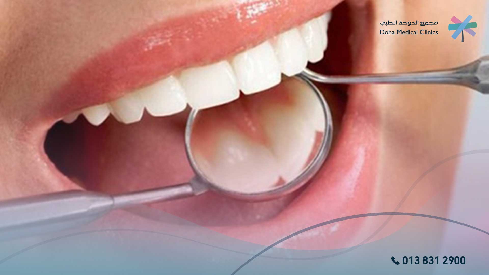 مدة شفاء خراج الأسنان الداخل