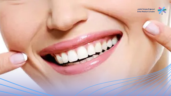 خطوط الابتسامه
