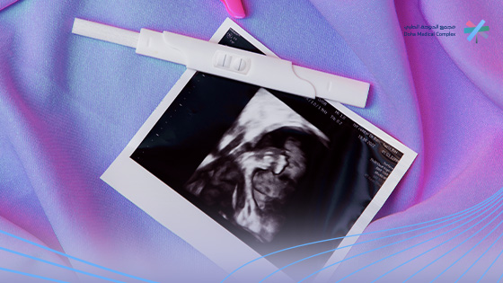 الحمل-بعد-التكميم