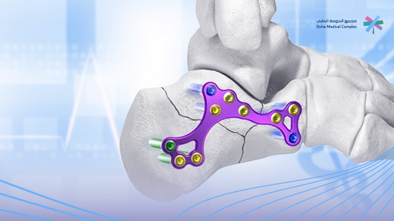 تكلفة-عملية-إزالة-الشرائح-والمسامير-في-السعودية