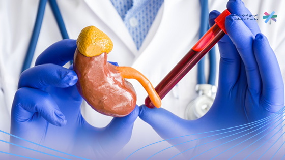 تحليل-الغدة-الكظرية