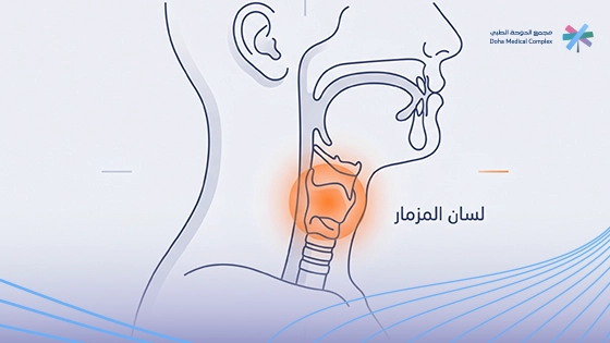 اسباب-التهاب-لسان-المزمار-وطرق-علاجه