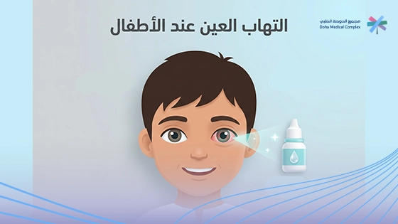 اسباب احمرار العين عند الاطفال