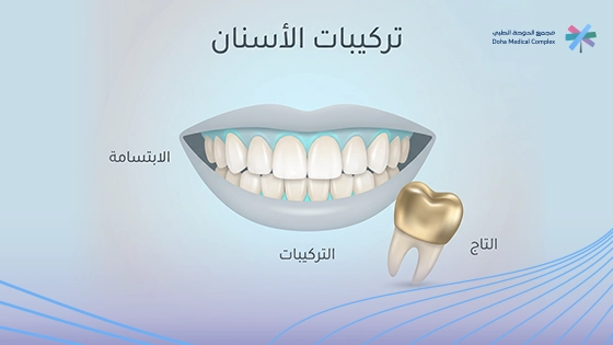 افضل أنواع الأسنان التركيب