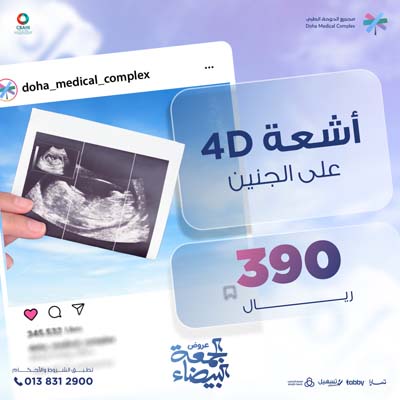 أشعة 4D على الجنين