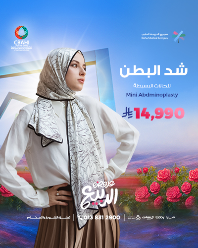 شد البطن للحالات البسيطة