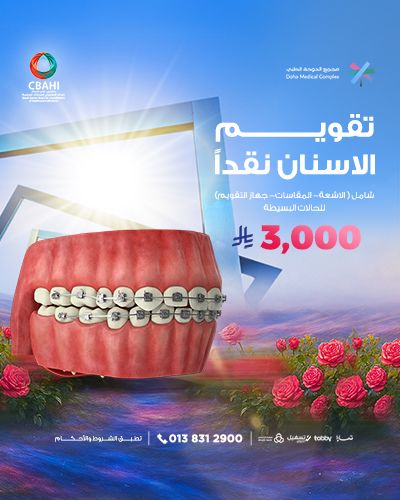 تقويم الأسنان نقداً للحالات البسيطة